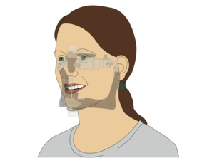 Illustration des Moduls zebris Fast Transfer
