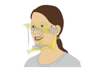 Illustration des Moduls CEREC Artikulator