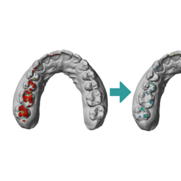 Korrektur von Durchdringungen an Intraoralscans